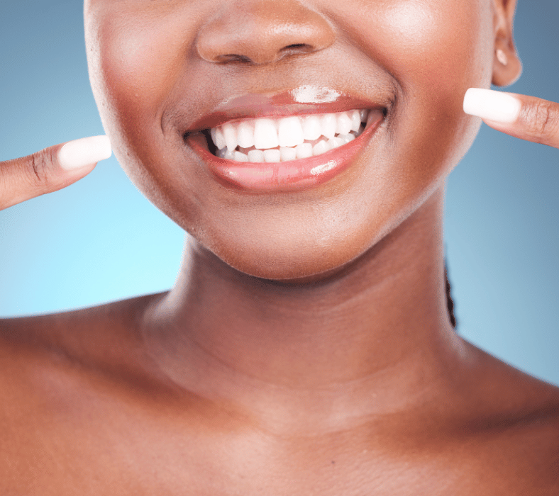 Dental Bonding in Sandy Springs GA
